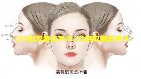 CFS割双眼皮手术 cfs割双眼皮手术